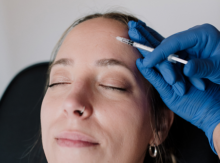 Microneedling 3 benefit from nad iv therapy