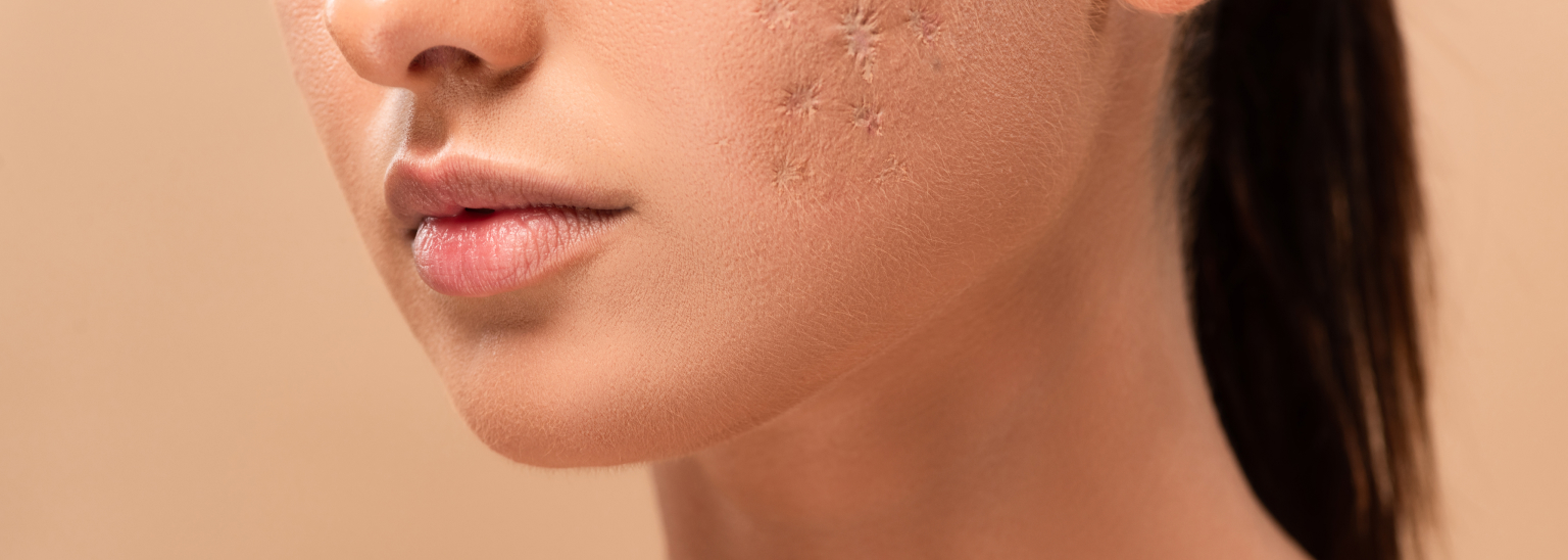 Why Sedona Residents Are Turning to Preventative Botox in Their 30s