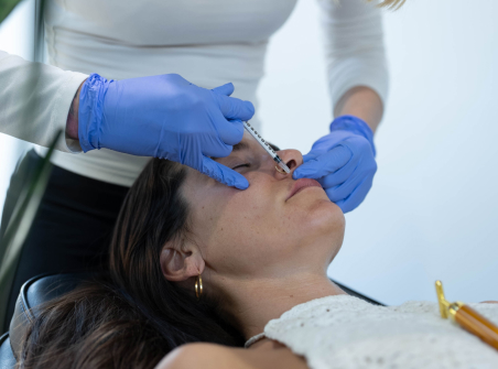 Dermal Fillers 1 dermal fillers Result