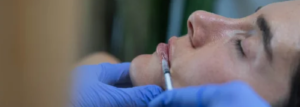 Ziawellness 15 Botox Aftercare Simple Tips to Help Your Results Last Longer
