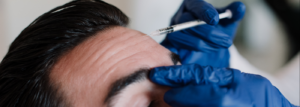 Ziawellness 16 Botox for Men in Sedona Why More Men Are Choosing Cosmetic Injectables